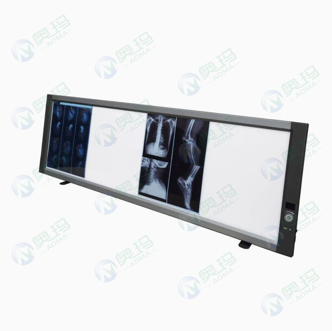 Digital X-ray viewer