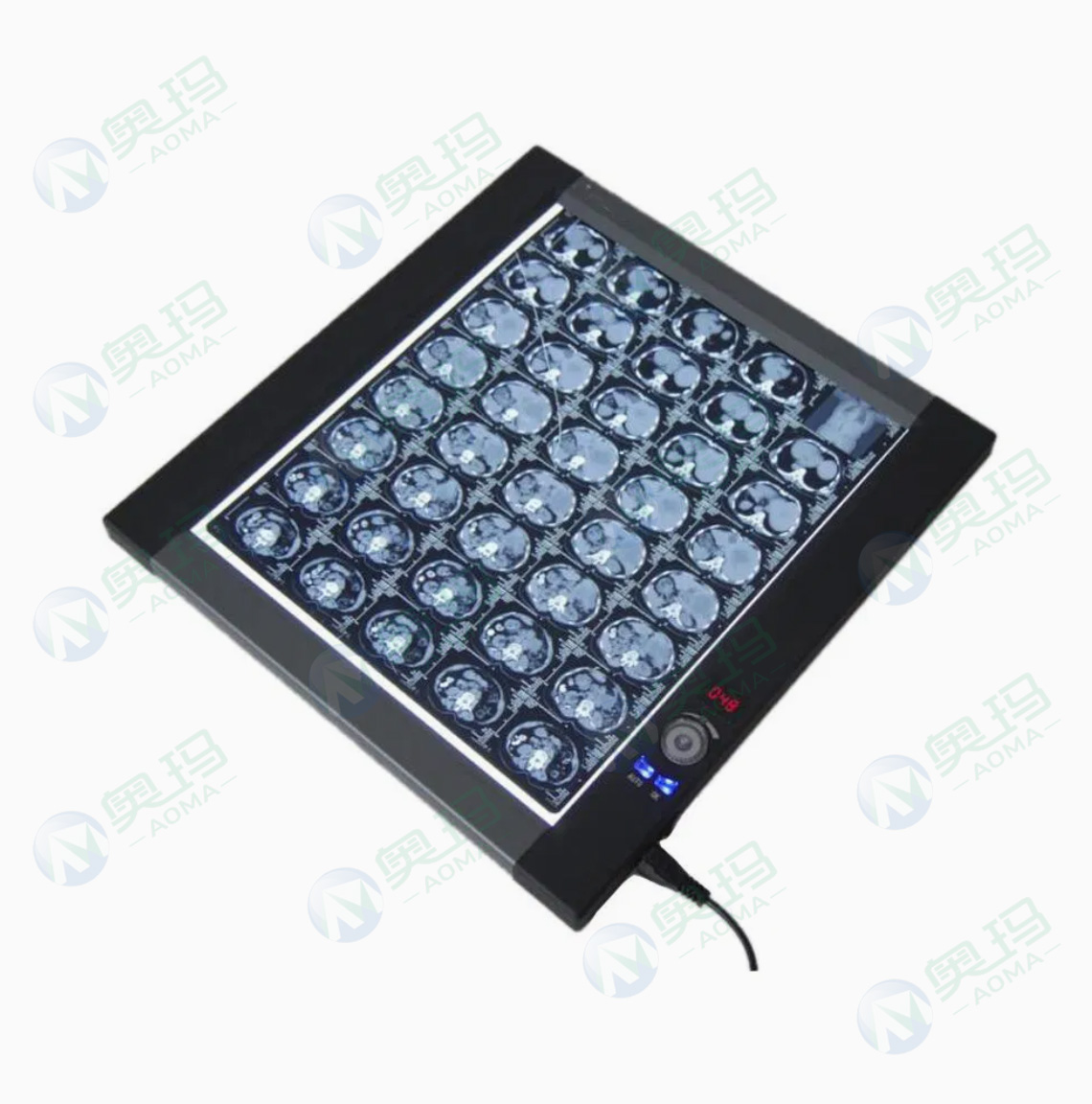 Digital X-ray viewer