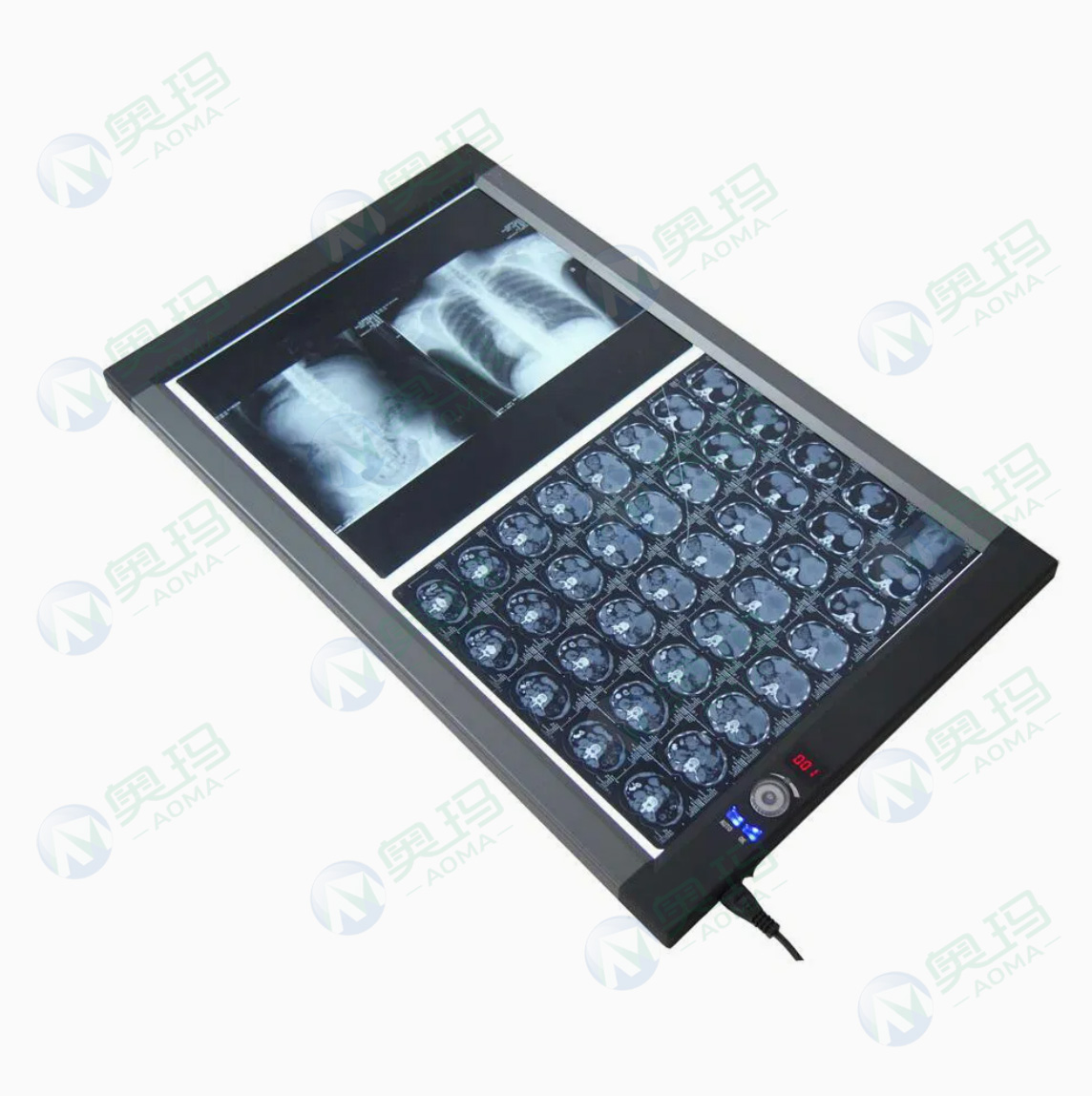 X-ray viewer