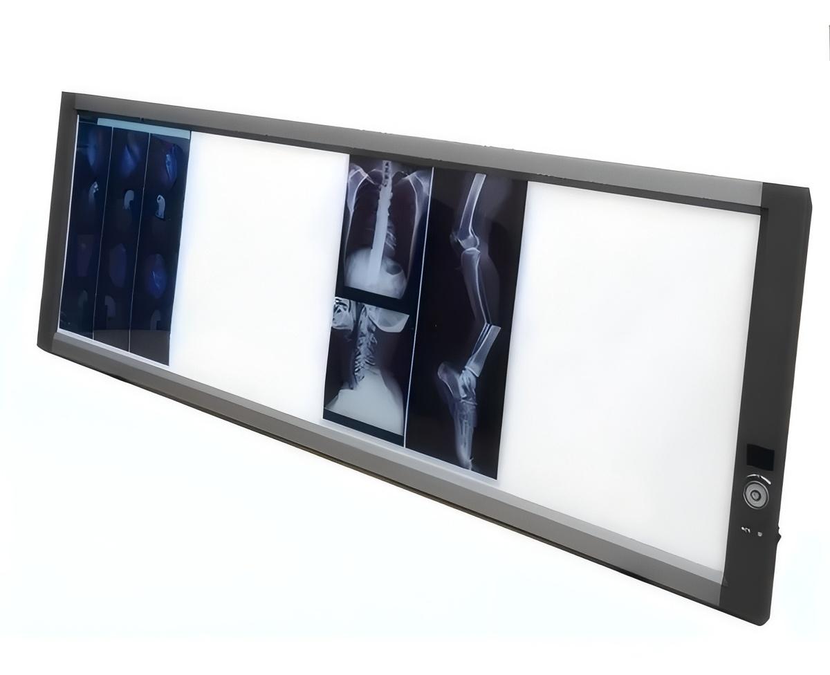 Medical Negatoscope Medical Negatoscope