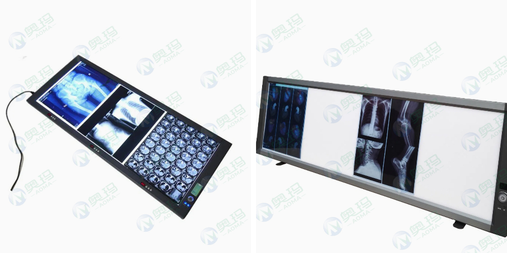 Digital X-ray Viewer Digital X-ray Viewer