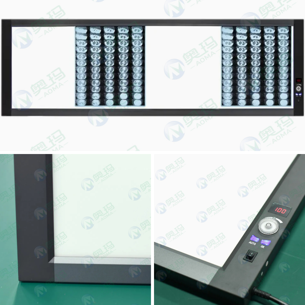 Digital X-ray viewer Digital X-ray viewer